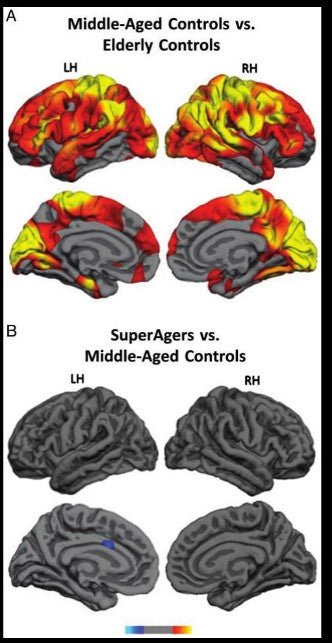 How Olfactory Health Links to Cognitive Longevity and Ageing - Longevity Box