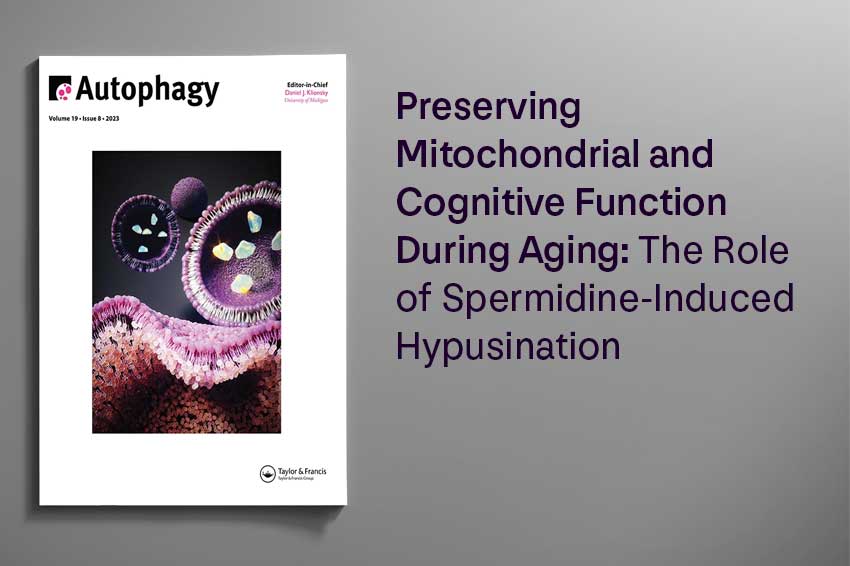 Preserving Mitochondrial and Cognitive Function During Aging: The Role of Spermidine-Induced Hypusination - Longevity Box